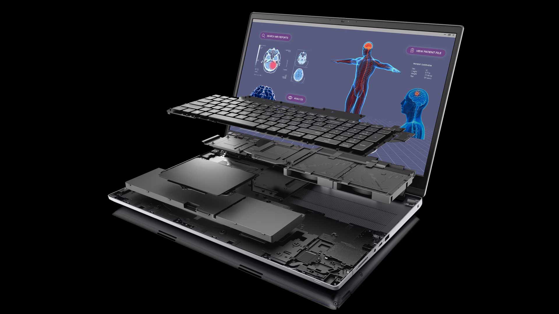 Dell precision 17 7780 Explosion