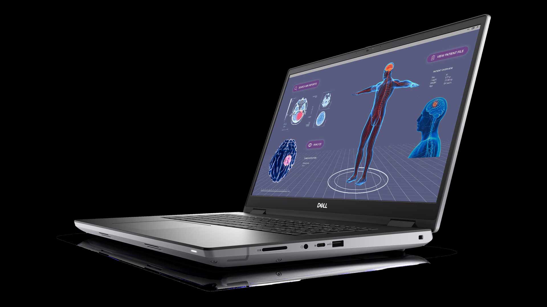 Dell precision 17 7780 Side